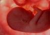 Толкование сна эмбрион в сонниках